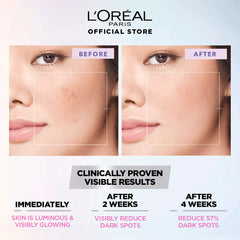 L'Oreal Glowing & Peeling Facial Toner with Glycolic Acid, 128ml