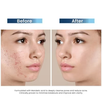 Clariderm Serum