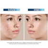 Clariderm Serum